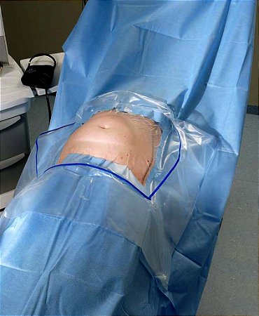 Kit Cirúrgico Cesárea