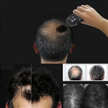 Maquiagem Capilar para disfarçar Calvície Queda de Cabelo