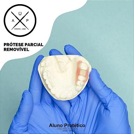 Prótese Parcial Removível