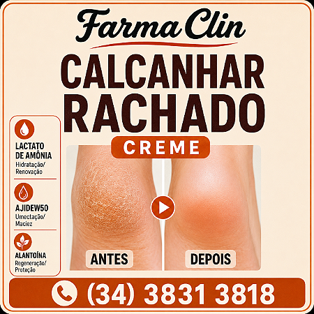 Calcanhar ou Seios Rachados