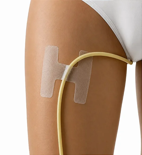 Adesivo Fixador Cateter Sonda Vesical HelpFix 10 Unidades