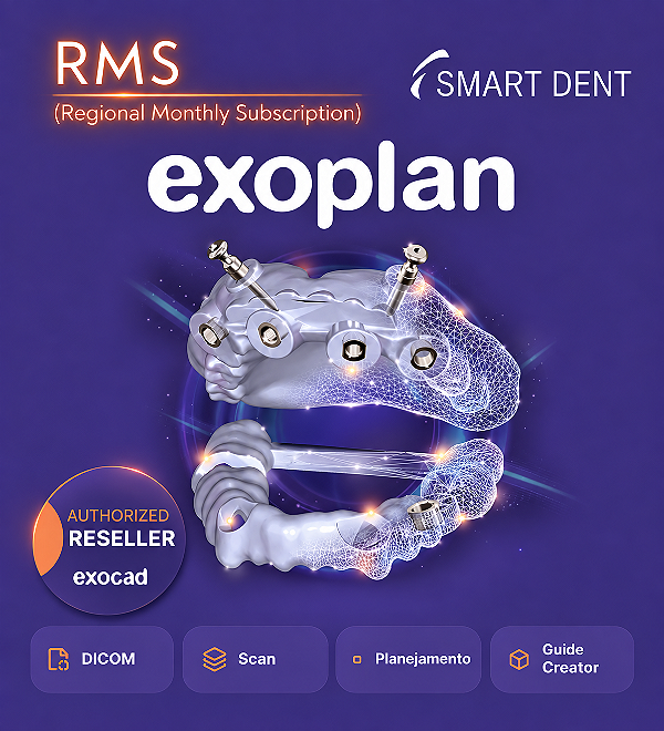 Ativação e Implantação exoplan RMS + Guide Creator
