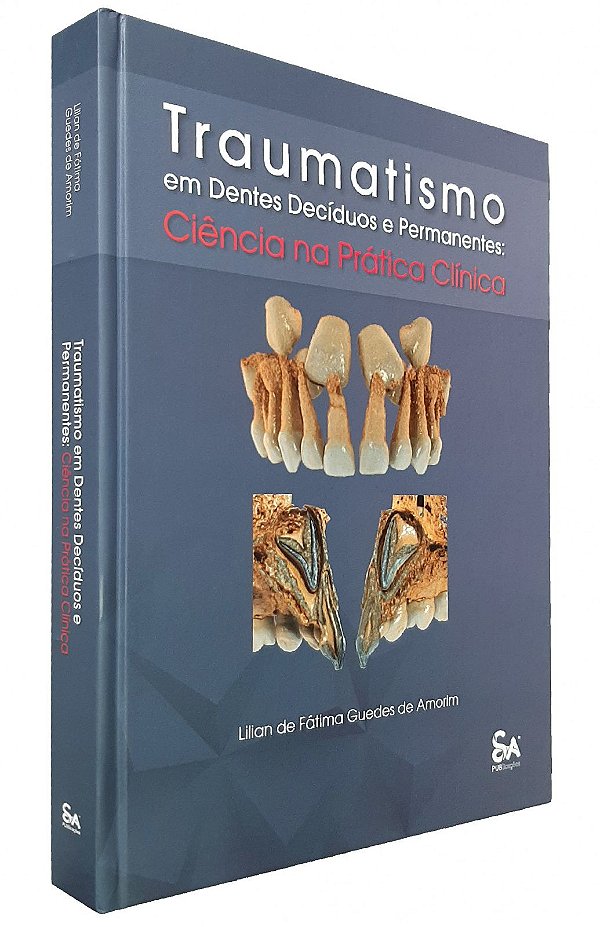 Traumatismo em Dentes Decíduos e Permanentes: Ciência na Prática Clínica - 1ª Edição 2021