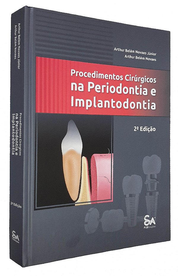 PROCEDIMENTOS CIRÚRGICOS NA PERIODONTIA E IMPLANTODONTIA - 2ª Edição 2022