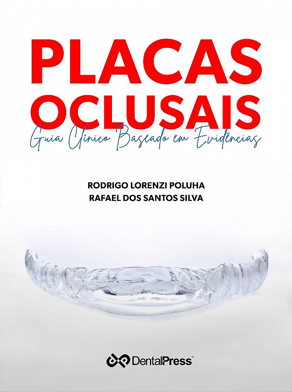 PLACAS OCLUSAIS: GUIA CLÍNICO BASEADO EM EVIDENCIAS - 1ª Edição 2023