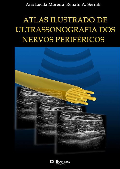 Atlas Ilustrado Ultrasonografia dos Nervos Perifericos - 1ª Edição 2024
