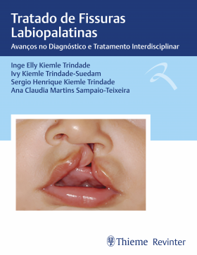 Tratado de Fissuras Labiopalatinas- Avanços no Diag.e Trat.interdisciplinar - 1ª Edição 2025