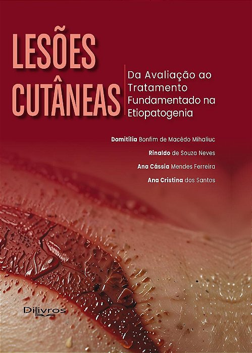 Lesões Cutâneas: Da Avaliação ao Tratamento Fundamentado na Etiopatogenia - 1ª Edição 2024