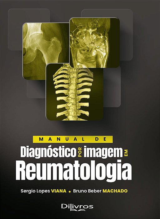 Manual de Diagnóstico por Imagem em Reumatologia - 1ª Ediçã 2024