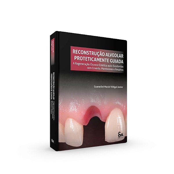 Reconstrução Alveolar Proteticamente Guiada (RAPG) - 1ª Edição 2024