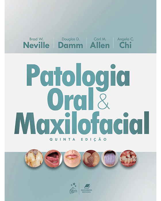 Patologia Oral e Maxilofacial - 5ª Ed/2025