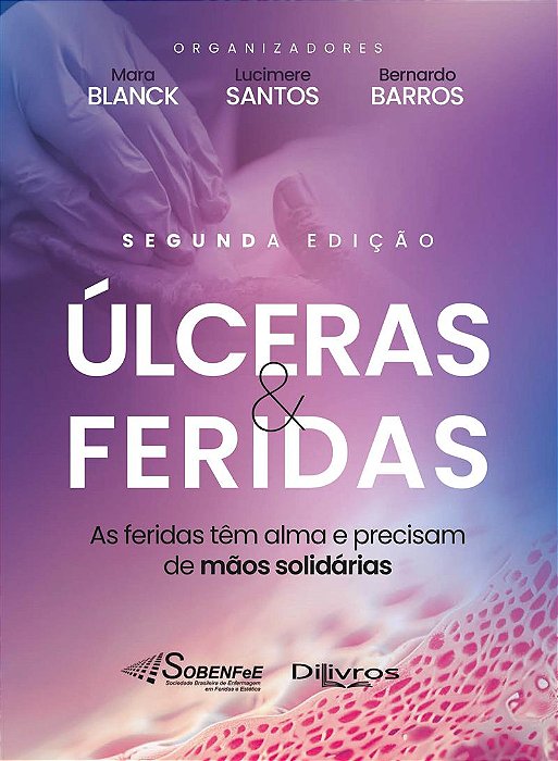 Ulceras e Feridas - 2ª Edição 2025