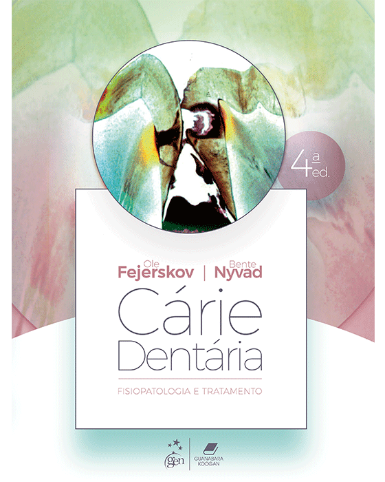 Cárie Dentária: Fisiopatologia e Tratamento - 4ª Edição 2026