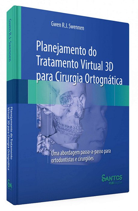 Planejamento do Tratamento Virtual 3D para Cirurgia Ortognática - 1ª Edição 2020