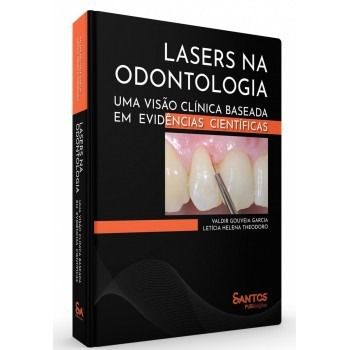 Lasers na Odontologia - Uma Visão Clínica Baseada em Envidências Científicas