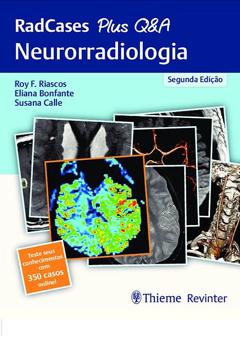 RadCases Plus Q&A - Neurorradiologia - 2ª Edição 2020