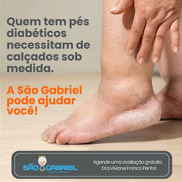 Calçado para pés Diabeticos Sob Medida