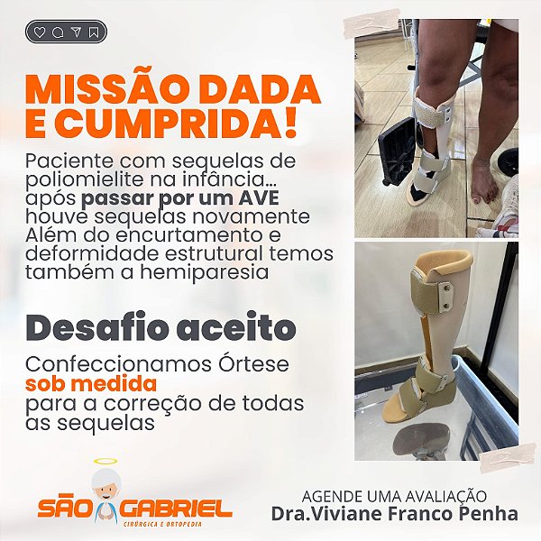 Órtese Sob Medida para Sequela de AVE