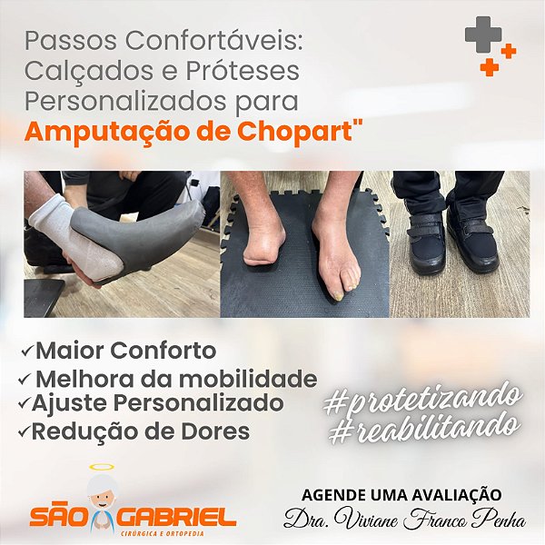Calçado para  Amputação de Chopart Sob Medida