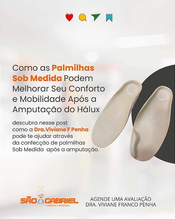 Palmilha Sob Molde de Gesso para amputação Hálux