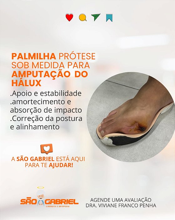Palmilha Prótese para amputação do Hálux