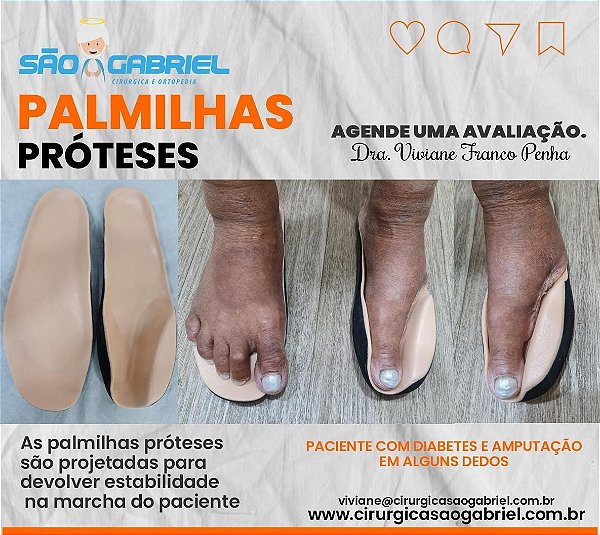 Palmilha Prótese Sob Medida