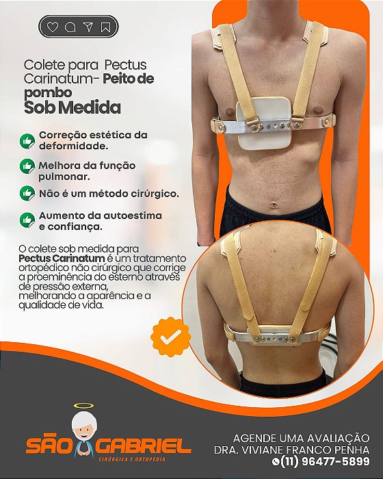 Colete Sob Medida para Pectus Carinatum- Peito de Pombo