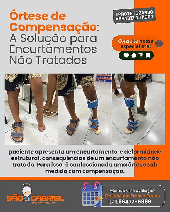 Órtese suropodalica com compensação Sob medida