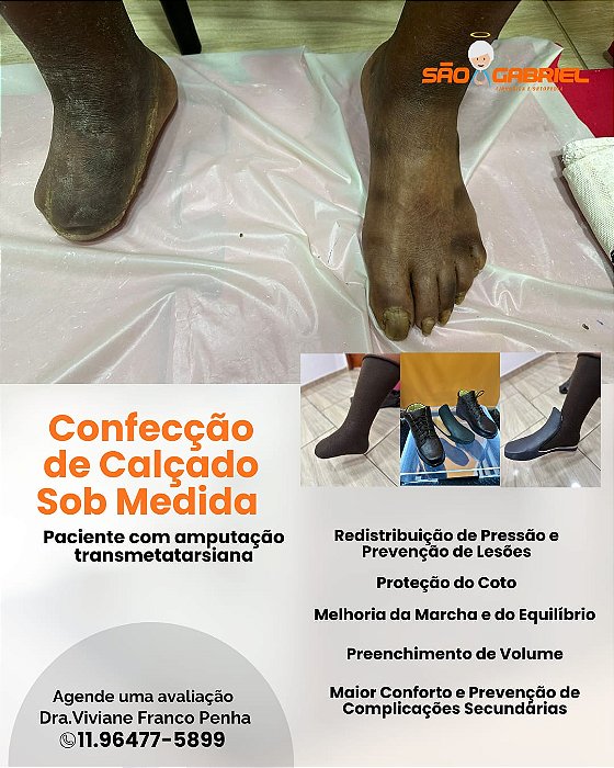 Calçado sob medida amputação Transmetatarsiana