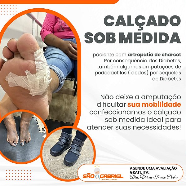 Calçado Sob Medida para Artropatia de Charcot