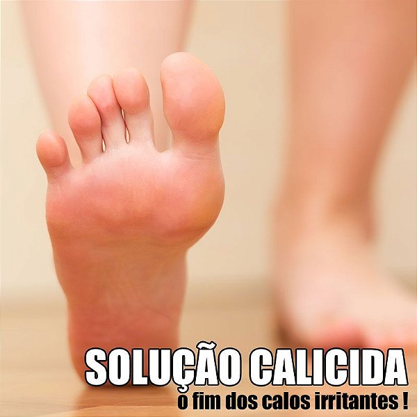 Solução Calicida (fim dos calos) - 20mL