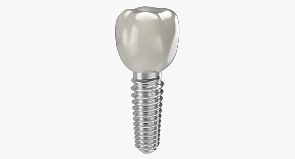 Modelo Anatômico Impante Dentário
