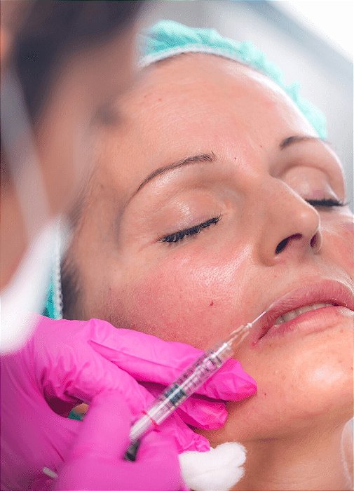 Curso Presencial: Preenchimento Dérmico & Conceitos Avançados em Harmonização Facial - (16 e 17 de Dezembro de 2023 em RECIFE/PE)