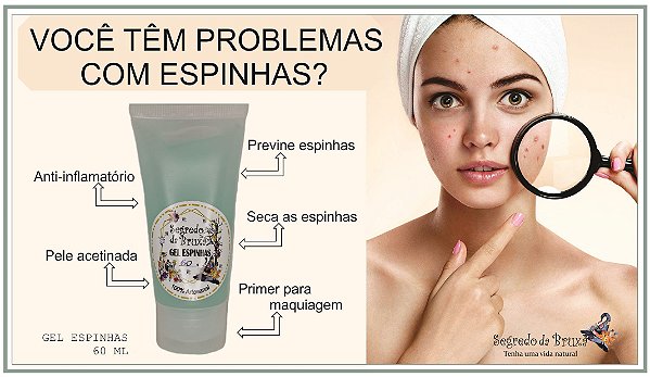 Gel para espinhas