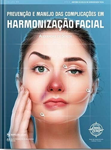 Livro Prevenção e Manejo das Complicações em Harmonização Facial Autor Souza, Alexandre de (2020) [usado]