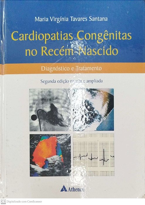 Livro Cardiopatia Congênitas no Recém-nascido: Diagnóstico e Tratament Autor Santana, Maria Virgínia Tavares (2005) [usado]
