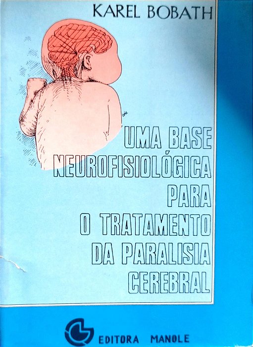 Livro Uma Base Neutofisiológica para o Tratamento da Paralisia Cerebral Autor Bobath, Karel [usado]