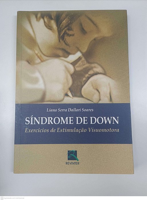 Livro Sindrome de Down - Exercicios de Estimulaçao Visuomotora Autor Soares, Liana Serra Dallari (2008) [usado]