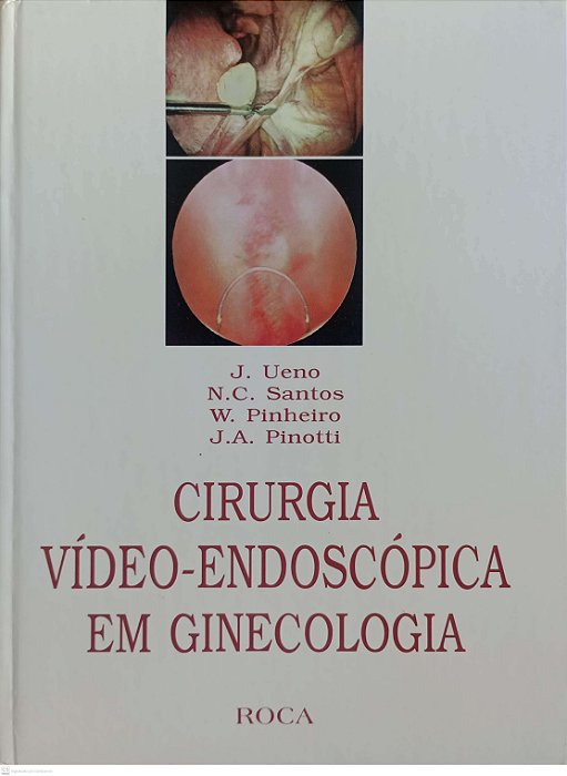 Livro Cirurgia Vídeo-endoscópica em Ginecologia Autor Ueno, J (1997) [usado]