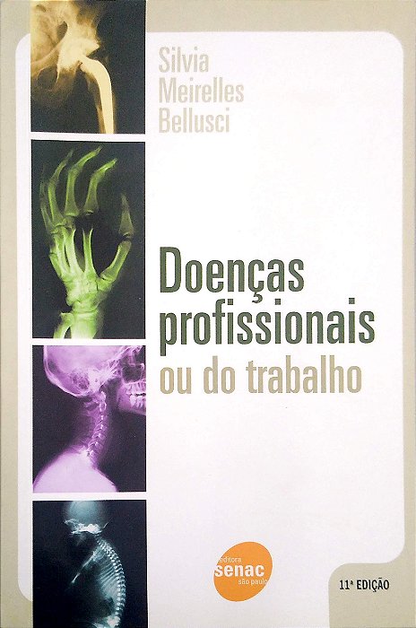 Livro Doenças Profissionais ou do Trabalho Autor Bellusci, Silvia Meirelles (1996) [usado]