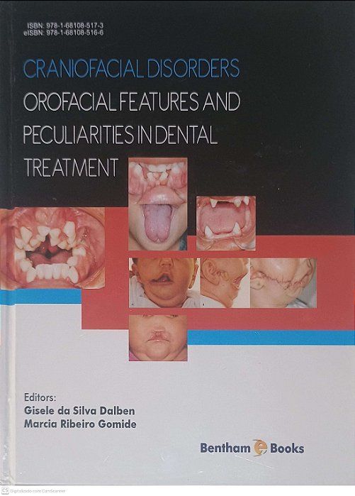 Livro Craniofacial Disorders Orofacial Features And Peculiarities Indental Treatment Autor Dalben, Gisele da Silva [usado]