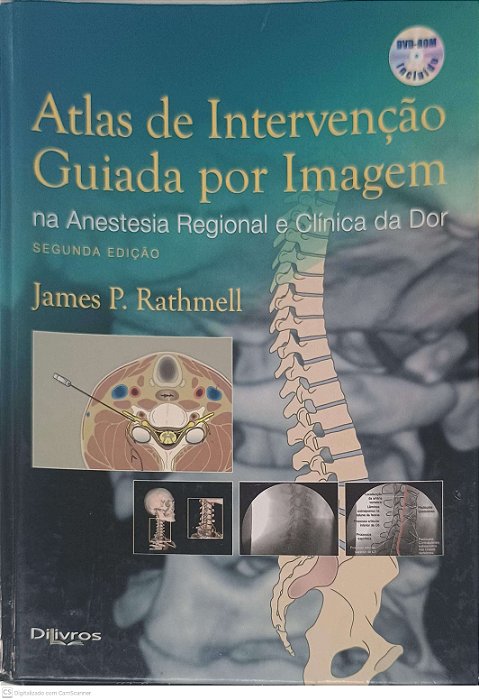 Livro Atlas de Intervenção Guiada por Imagem na Anestesia Regional e Clínica da Dor Autor Rathmell, James P. (2012) [usado]