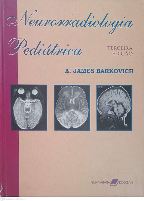 Livro Neurorradiologia Pediatrcia Autor Barkovich, A. James (2000) [usado]