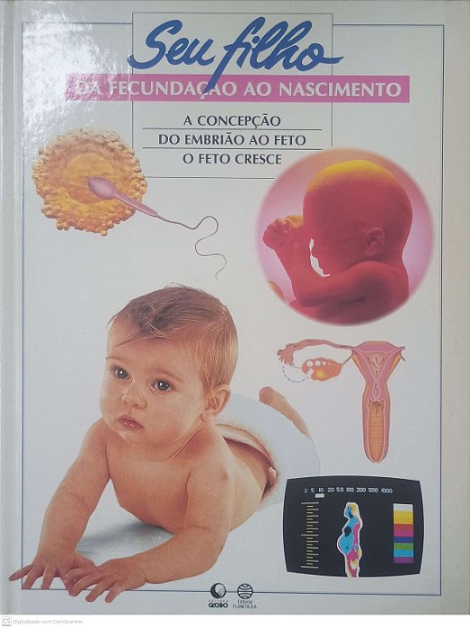 Livro seu Filho da Fecundação ao Nascimento Autor Fischer, Ricardo A. e Outros (1995) [usado]