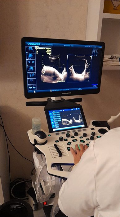 Ultrassom E10  - 3 Gerais + 3D/4D + Setorial- VINNO