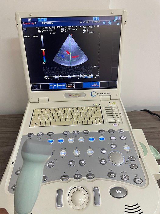 Ultrassom Portátil MyLab 30 Gold Cardiovascular - Setorial - ESAOTE