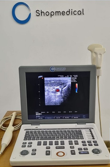 Ultrassom Portátil SonoAce R3 - 3 Gerais -  SAMSUNG MEDISON