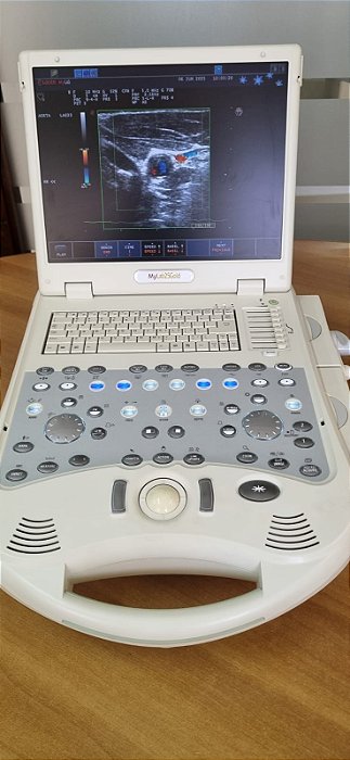 Ultrassom Portátil MyLab 25 Gold - Linear e Setorial Adulto - Esaote