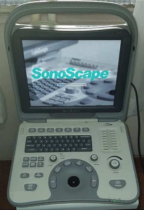 Ultrassom Portátil A5V - Linear e Microconvexo -  Sonoscape - VET