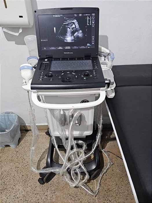 Ultrassom Portátil Versana Active - 3 Gerais + 3D/4D - GE